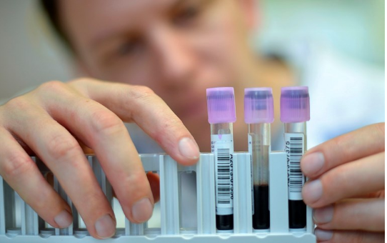 Shkencëtaret provojnë testin e ri për zbulimin e kancerit, do shpëtonte mijëra jetë!