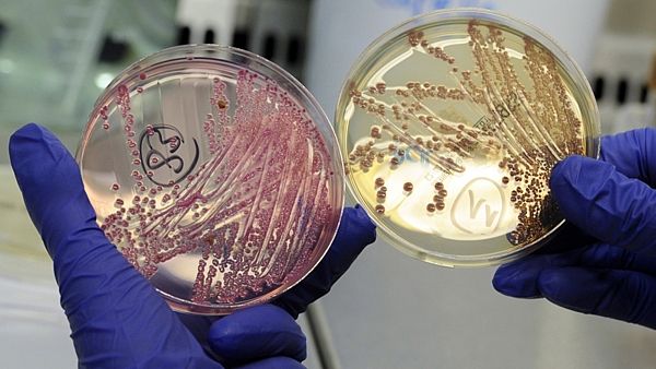 Zbulohet një ‘xham’ që e shkatërron bakterin E.coli