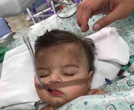 Vogëlushi pesë muajsh nga Podujeva ka nevojë për ndihmë, ai ka lindur me një sëmundje të rëndë