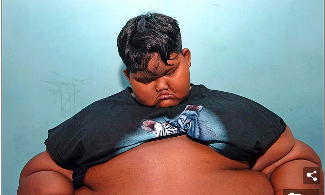 Djali më i trashë në botë është holluar për plot 106 kilogramë (VIDEO)