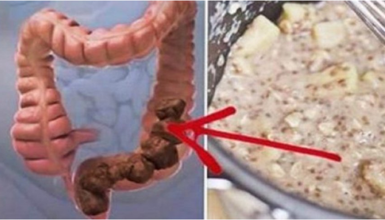 Ky është ushqimi i frikshëm që po shkakton kancer në masë