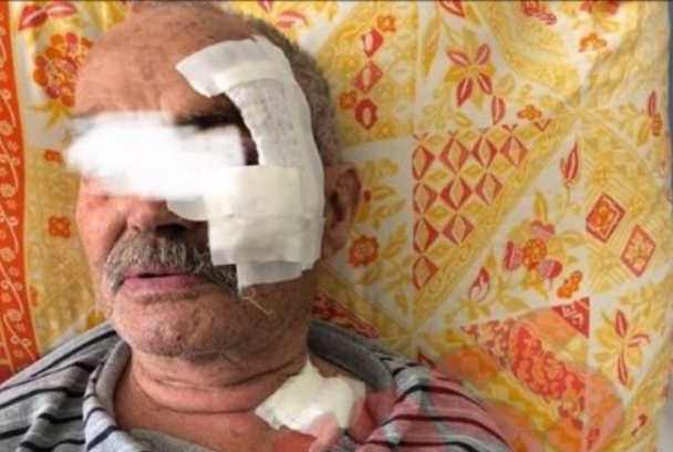 Shkon për t’u shëruar në QKUK, 82-vjeçarit i bie edhe tavani mbi kokë