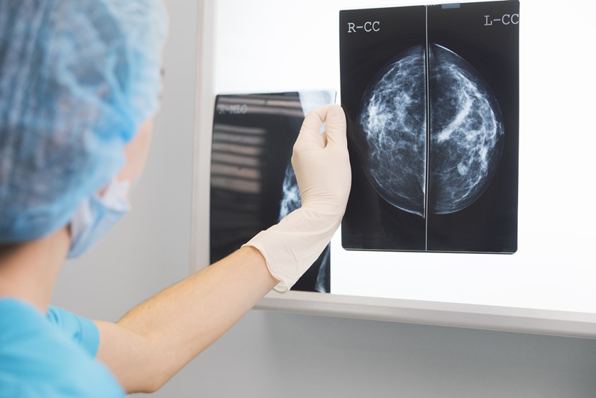 Nga sot shërbime falas të mamografisë
