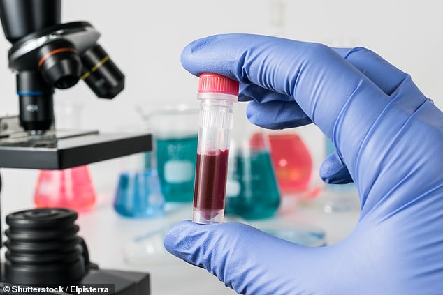 Studim: Testi i mençur i gjakut përcakton ilaçin preciz për gratë me kancer