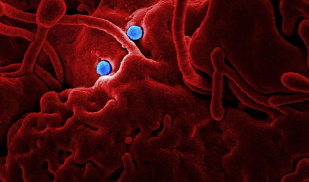 Mjekët paralajmërojnë: Koronavirusi transmetohet edhe përmes syve