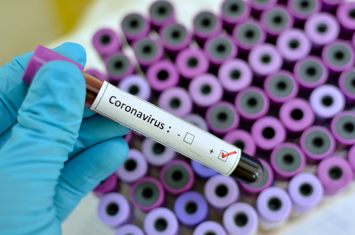 Shënohet viktima e parë e koronavirusit në Evropë