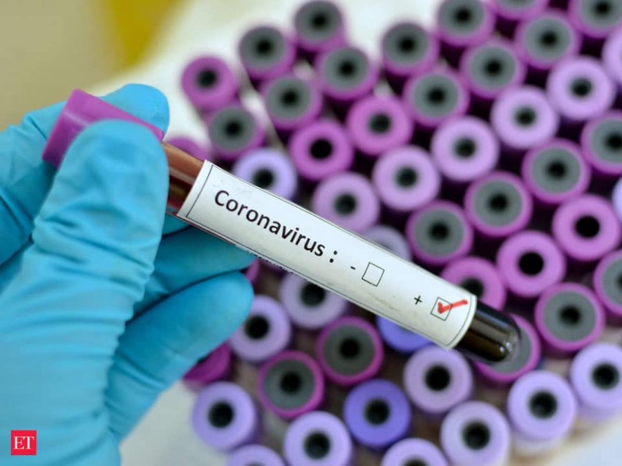 Konfirmohet edhe një shqiptar tjetër me koronavirus