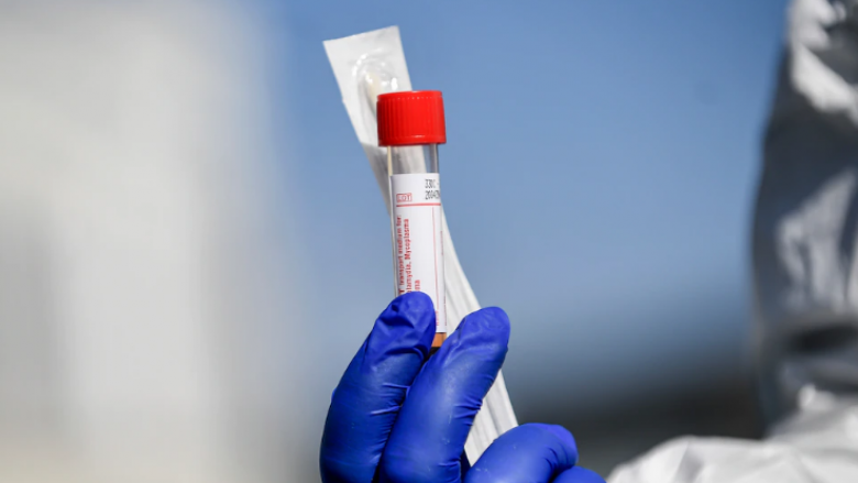 Testi shtëpiak për koronavirusin në Senegal: Rezultati për 10 minuta dhe do të kushtojë vetëm 1 dollar
