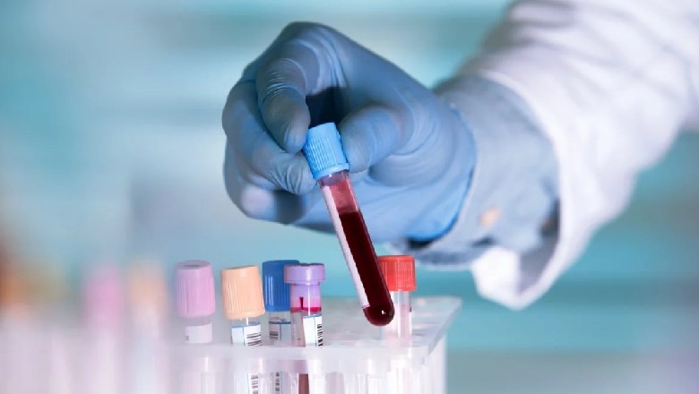 Kompania franceze prodhon testin e shpejtë: Vetëm me një pikë gjaku zbulon nëse je infektuar