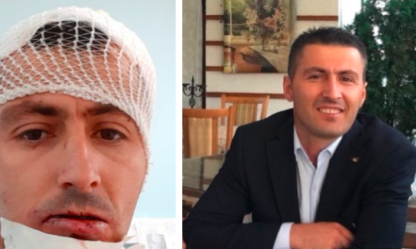 Kryeinspektori i Mitrovicës tregon se kush qëndron prapa sulmit kundër tij