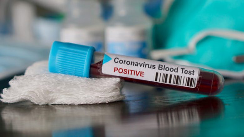 Bie numri i të infektuarve me coronavirus në Maqedoni