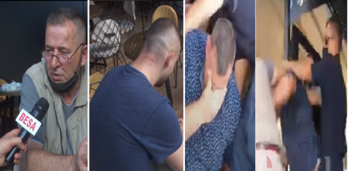 Flet pronari i kafenesë në Prizren: 18 policë na u futën në lokal, na rrahën në sy të fëmijëve