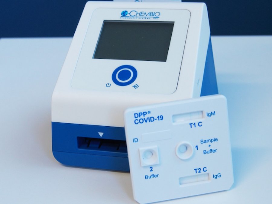 Aprovohet testi i ri për diagnostikimin e shpejtë të COVID-19