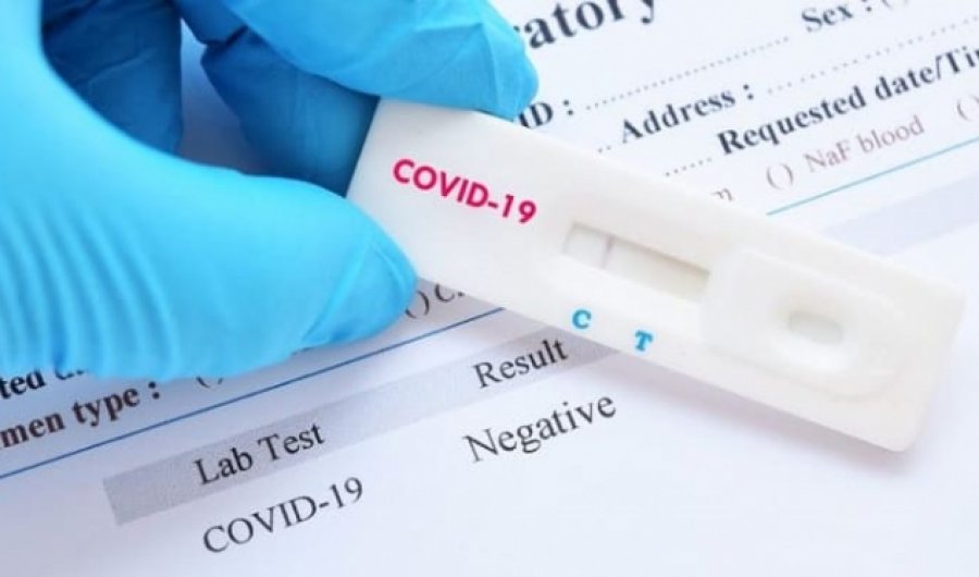 OBSH-ja do t’u ofrojë shteteve të varfra 120 milionë teste rapide për COVID-19