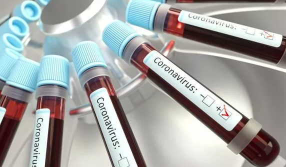 Këto grupe gjaku e vuajnë më shumë virusin COVID-19
