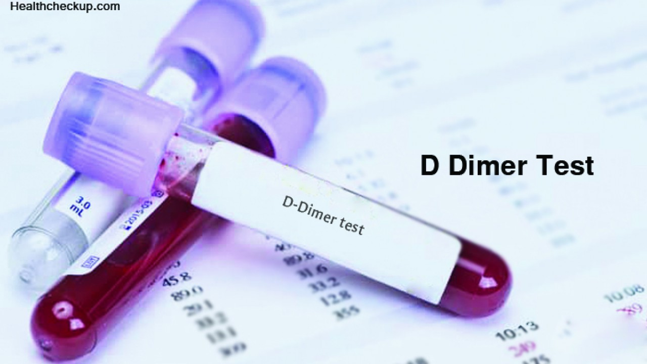 Testi D-dimer shumë shpejt në qendrat e mjekësisë në Prishtinë