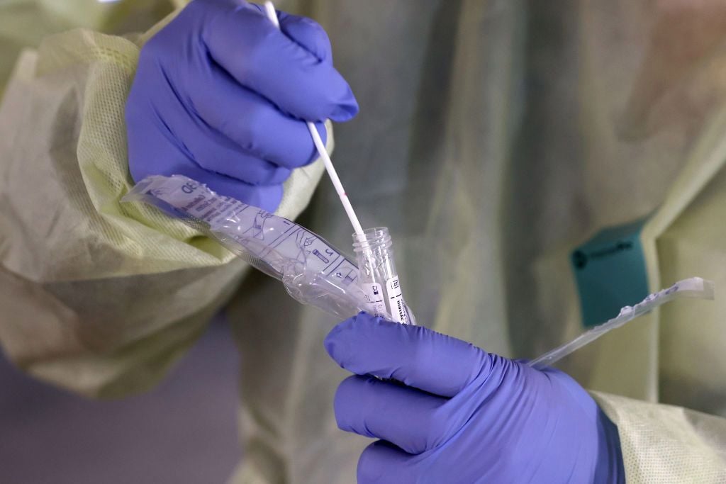 Furnizimi me teste PCR – shpallet fituese kompania që ndryshoi ofertën gjatë tenderimit