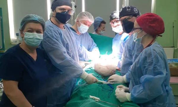 Mitrovicë: Mjekët i heqin pacientit tumorin 15 kilogramësh