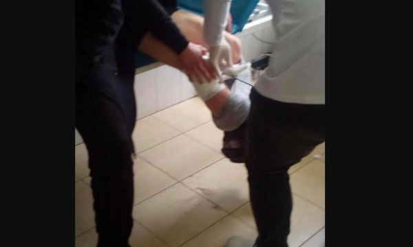 Tmerrohet familja në Suharekë, qeni i tërbuar ngjitet në katin e katërt e i sulmon, e mbysin me thikë