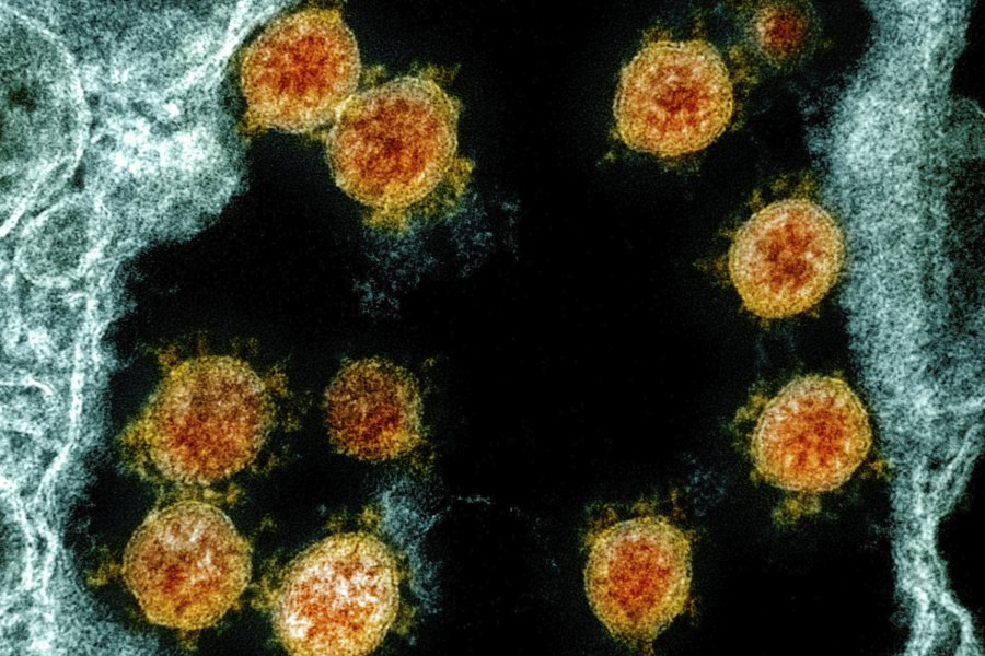 Varianti i koronavirusit i zbuluar në Indi po shqetëson shkencëtarët