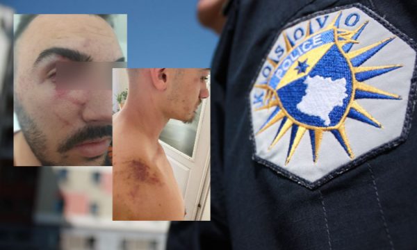 Katër të rinj denoncojnë policët për dhunë brutale në Gjilan: Na kanë rrahur deri në alivanosje