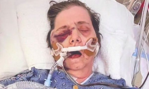 Zihet me infermieren, e moshuara vdes nga plagët e marra në spital