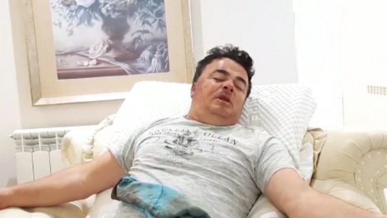 Grabitet biznesmeni në Shqipëri: 10 persona më prenë gishtin dhe morën 100 mijë euro