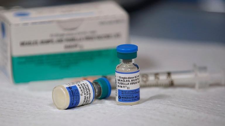 22 milionë foshnja nuk u vaksinuan kundër fruthit gjatë pandemisë, CDC paralajmëron shpërndarje të sëmundjes