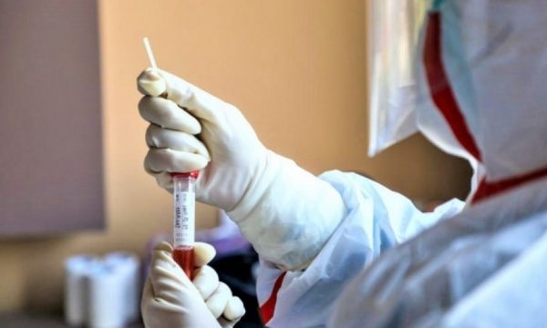 Mbi pesë milionë viktima me koronavirus në botë