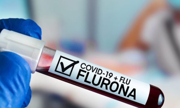 Çfarë është Flurona dhe cilat janë simptomat